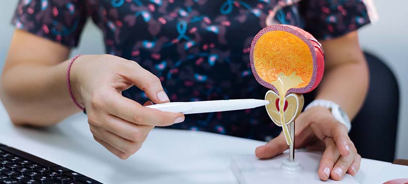 sindrome da bexiga hiperativa